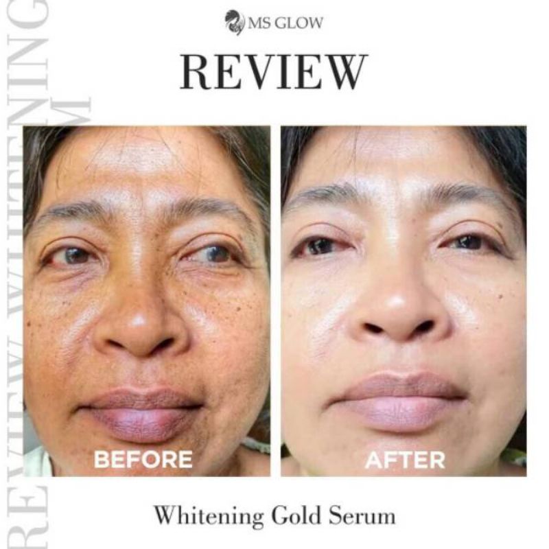 SERUM WHITENING GOLD ORIGINAL MS GLOW (SUDAH BER BARCODE TERBARU)