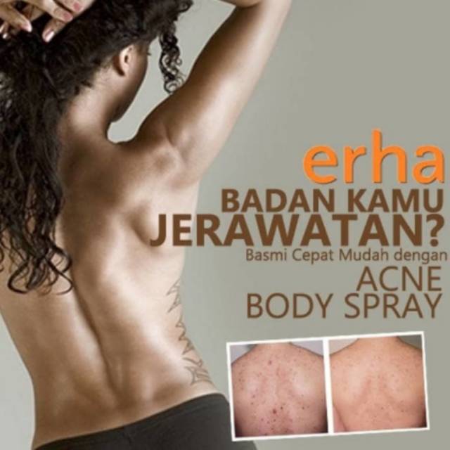 Erha Acne Back Spray Original - Spray Anti Jerawat Badan