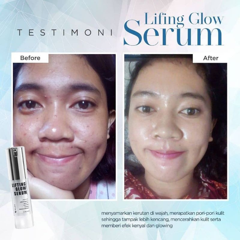SERUM LIFTING MSGLOW LIFTING GLOW SERUM WHITENING LIFTING SERUM MSGLOW BEAUTY