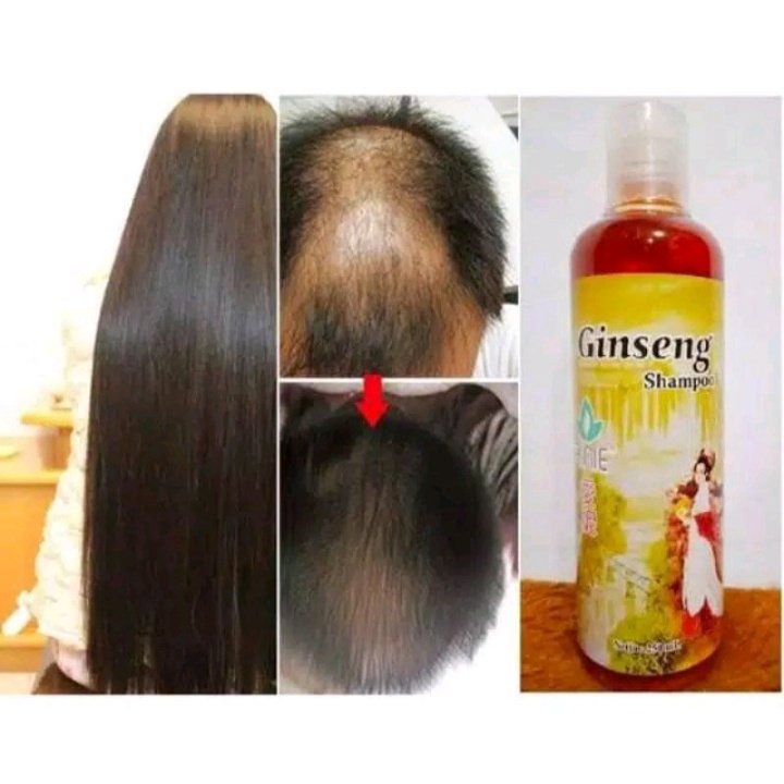 [BISA COD] Shampo Ginseng Penumbuh Rambut Obat Botak Shampo Anti Rontok Vitamin Rambut Hair Care Anti Ketombe