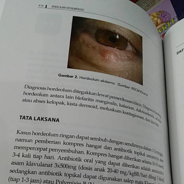 ( ORIGINAL ) BUKU AJAR OFTALMOLOGI EDISI 1 FKUI Th.2020