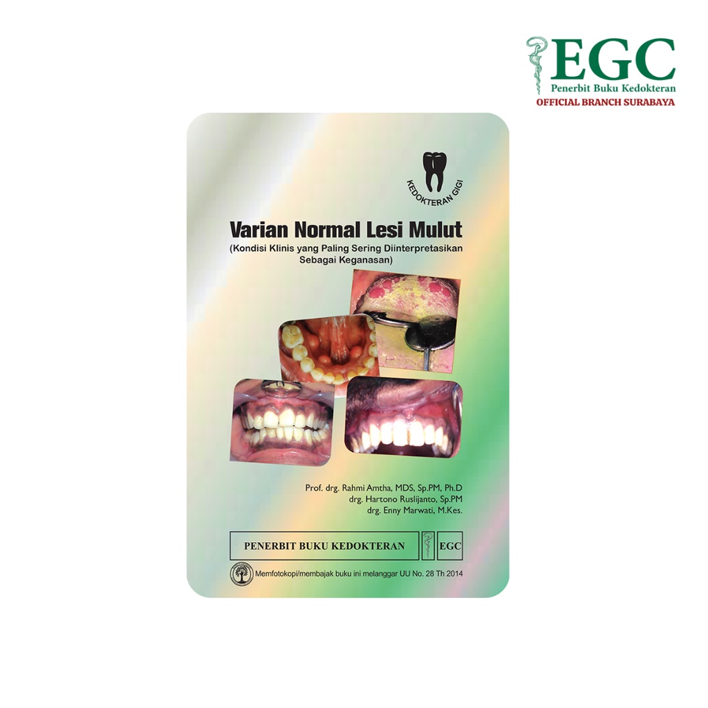 Varian Normal Lesi Mulut