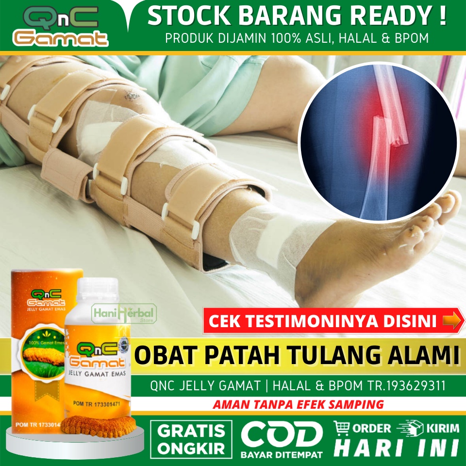 OBAT PATAH TULANG DAN RETAK / REMUK - OBAT HERBAL PATAH TULANG UNTUK ANAK & DEWASA - OBAT PATAH TULA