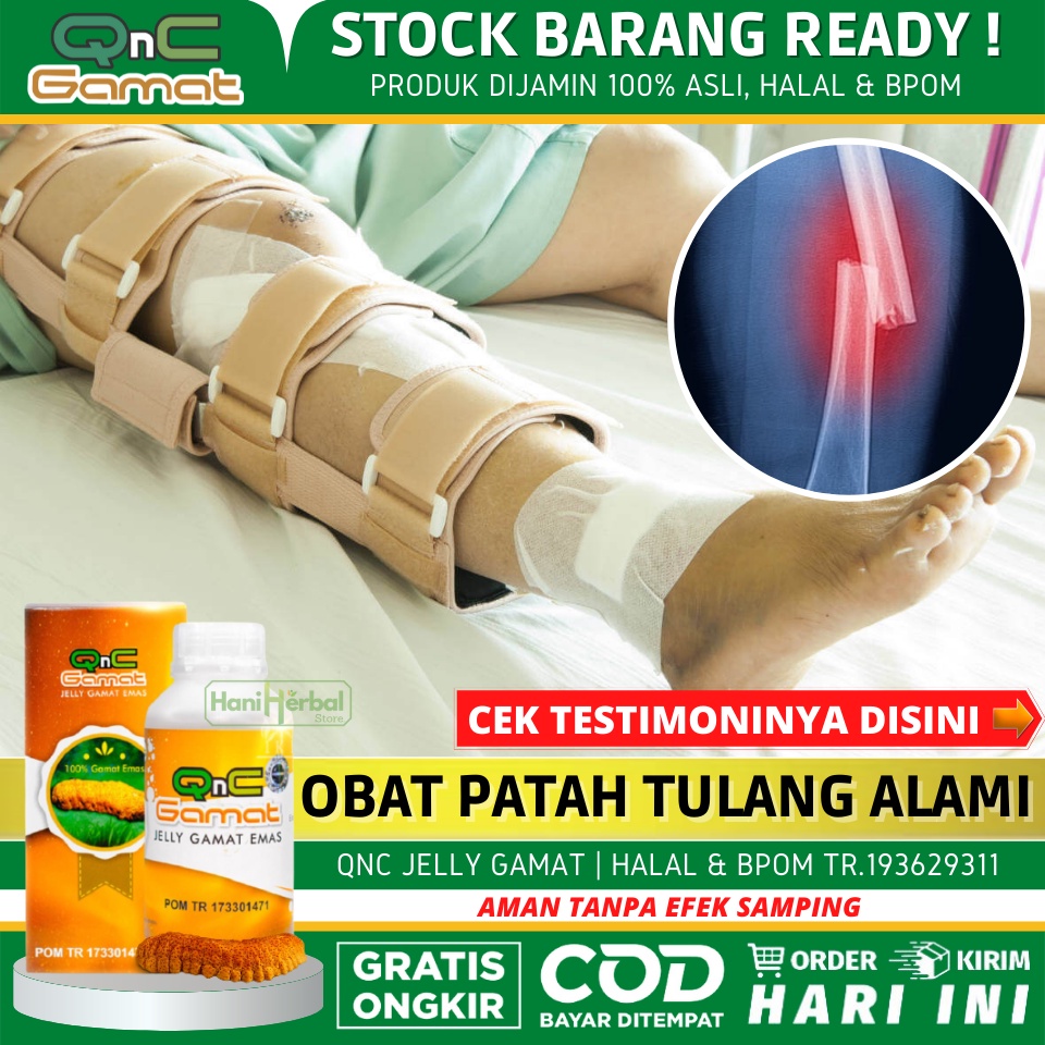 Jual Obat Kaki Bengkak Patah Tulang Tulang Retak Lutut Bengkak