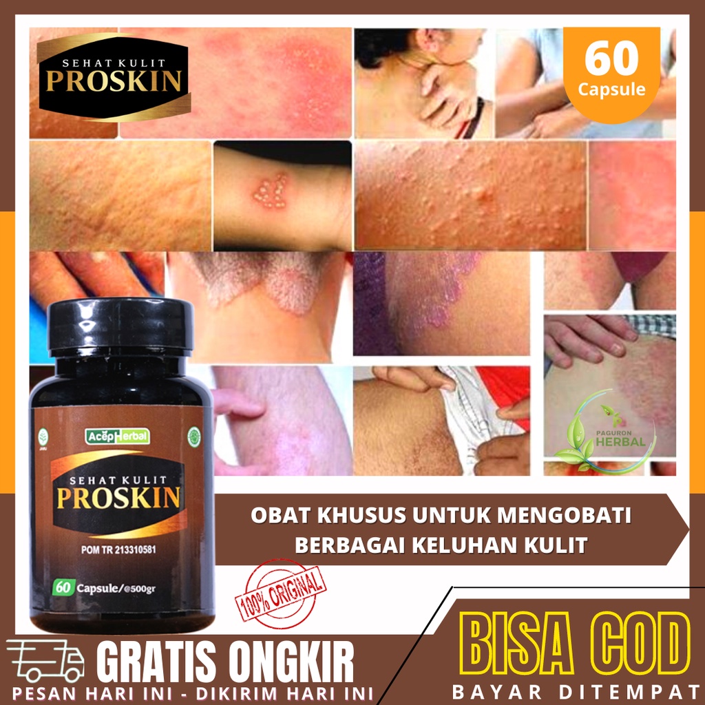 Obat Gatal Gatal, Gatal Seluruh Tubuh, Gatal Selangkangan Atasi Dengan Suplemen PROSKIN