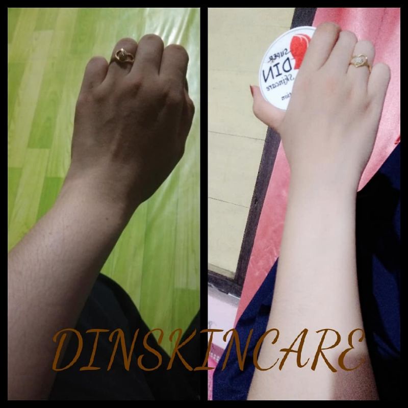hb dinskincare makassar /hb pemutih bpom /hb pemutih ampuh