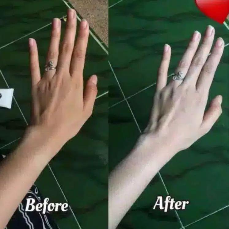 HB DOSTING KODE AGR 004001 ORIGINAL 100% GARANSI UANG KEMBALI DOSIS TINGGI WHITENING PEMUTIH BADAN S