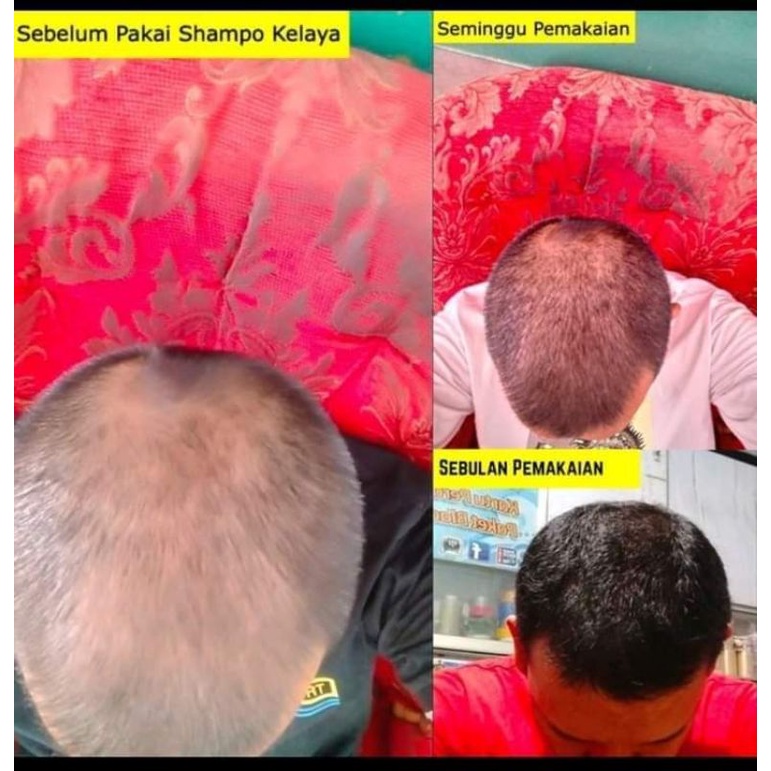 KELAYA shampoo Hair Treatment | shampo penumbuh rambut botak BPOM