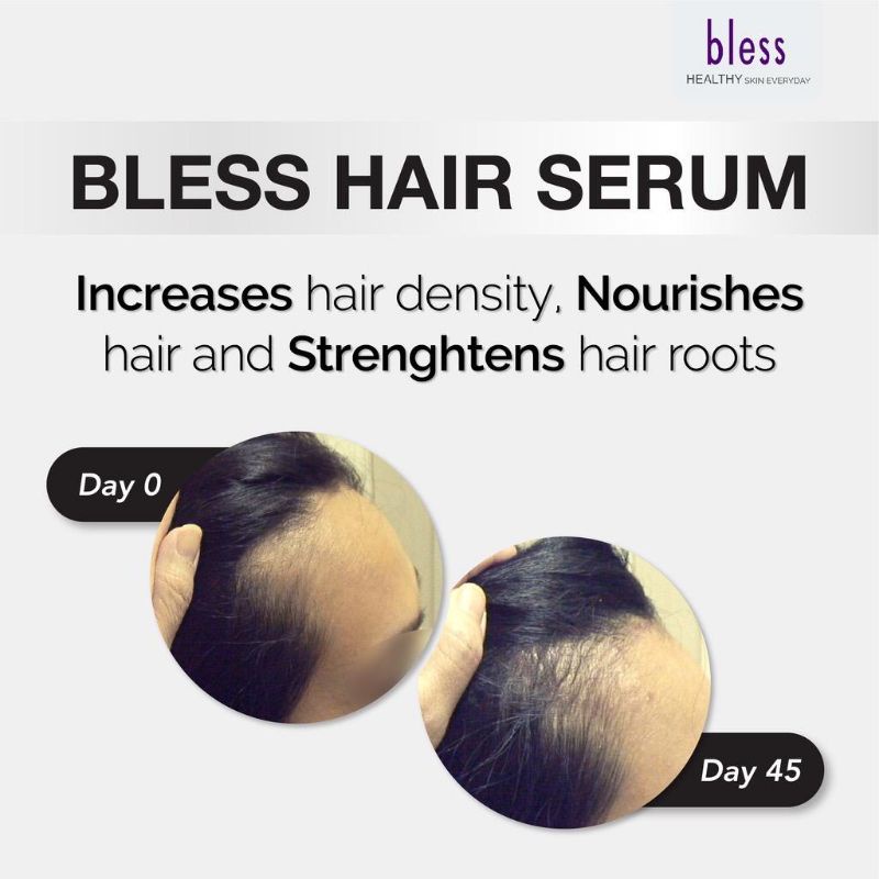 Bless Hair Serum | Serum Rambut Rontok 50 ml