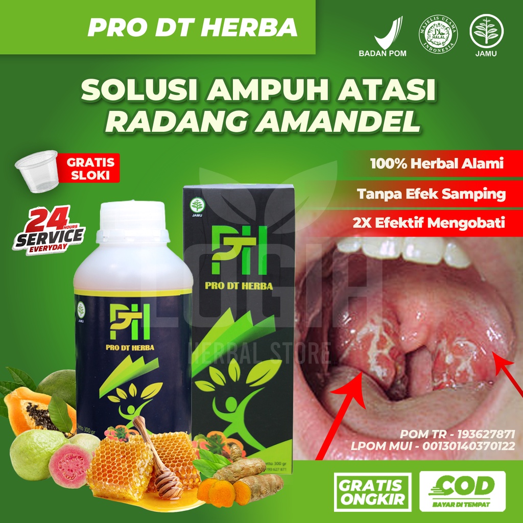 Jual Obat Amandel Radang Tenggorokan Tonsilitis Herbal Pada Dewasa