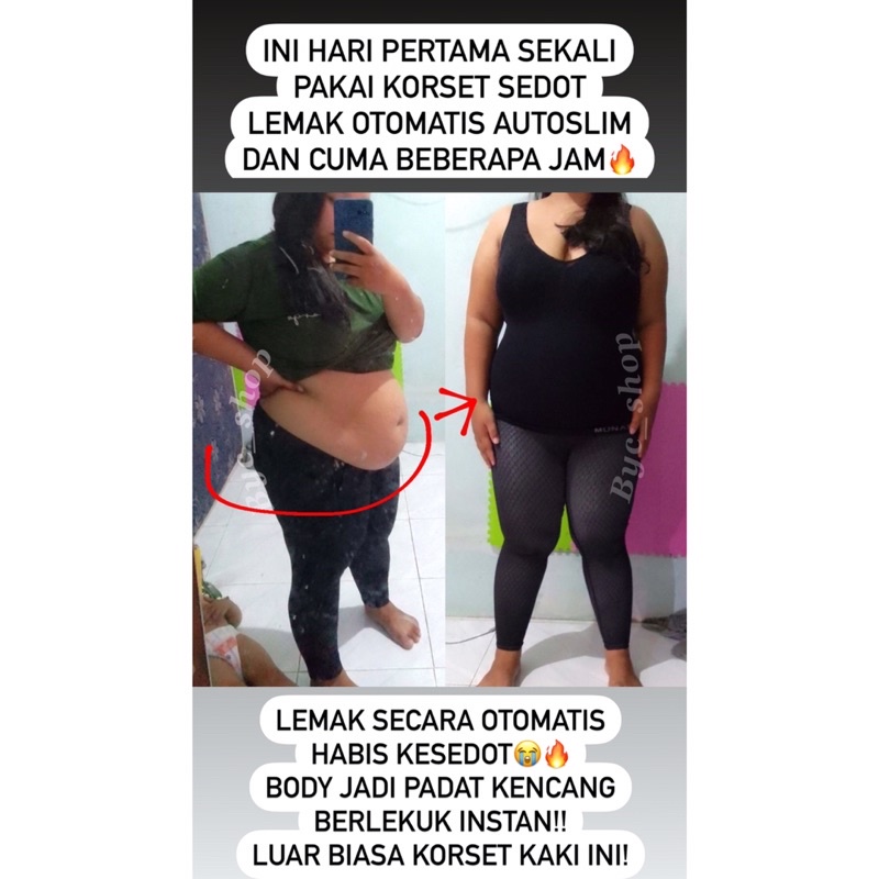 Korset SEDOT LEMAK AUTOSLIM ANTOINETTE