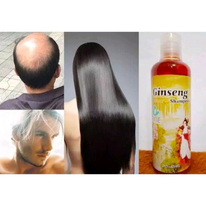 [BISA COD] Shampo Ginseng Penumbuh Rambut Obat Botak Shampo Anti Rontok Vitamin Rambut Hair Care Anti Ketombe