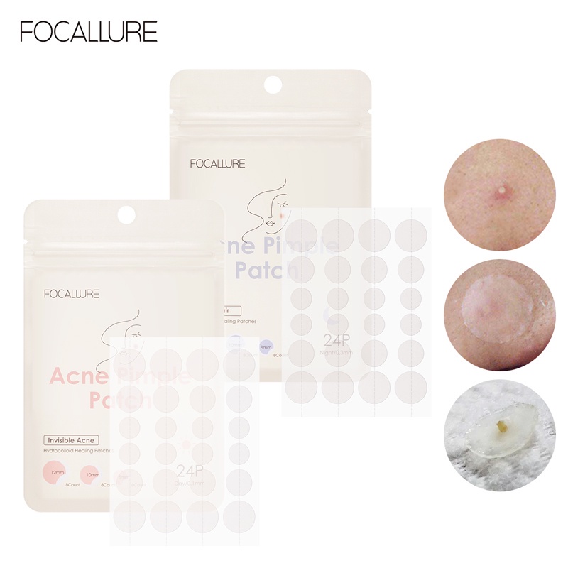 FOCALLURE Spot Patch Acne Treatment Day &amp; Night / PATCH PENGHILANG JERAWAT