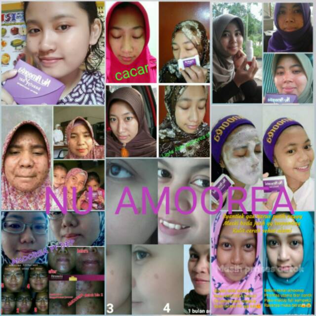 Paket perawatan kecantikan premium Khusus KULIT BERMINYAK Nu Amoorea Beauty Series Lengkap Hemat