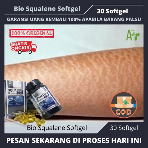 Obat Kaki Bersisik Dan Kering, Obat Kulit Kaki Kering. Obat Kulit Kaki Kering Dan Pecah, Obat Kulit 