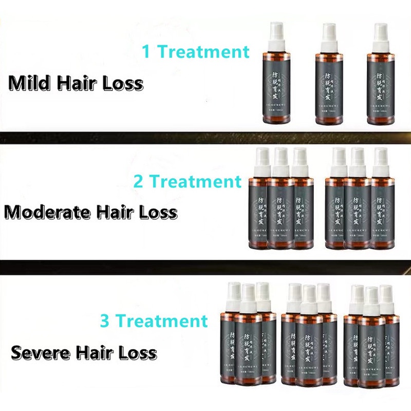 Minyak Penumbuh Rambut Botak Dan Rontok Essence Anti Rontok Mempercepat Pertumbuhan Rambut Pria Anak Bayi Balita -100ml