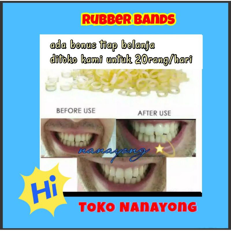 Rubber bands#Karet gigi elastis#merapatkan gigi renggang