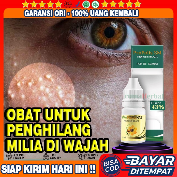 Obat Milia di Kelopak Mata - 100% Propolis SM Brazil Asli Berkhasiat