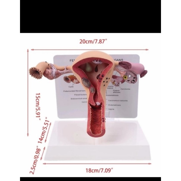 manekin uterus