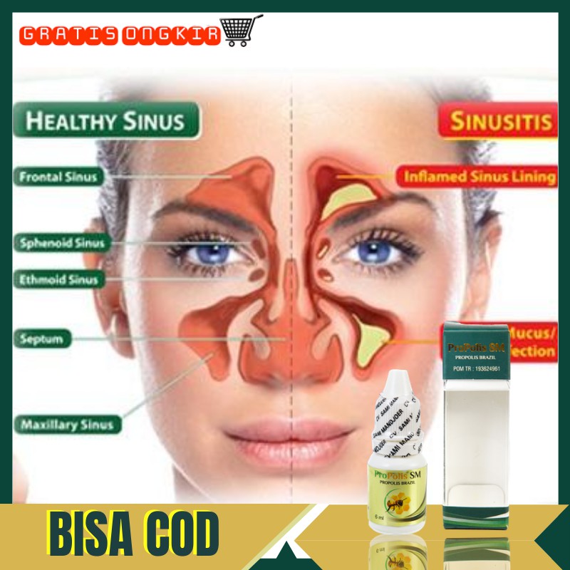 Obat Tetes Sinusitis Hidung Kronis Izin BPOM Propolis SM Brazillian Original