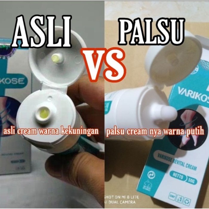 VARIKOSE ASLI ORIGINAL OBAT VARISES AMAN BPOM