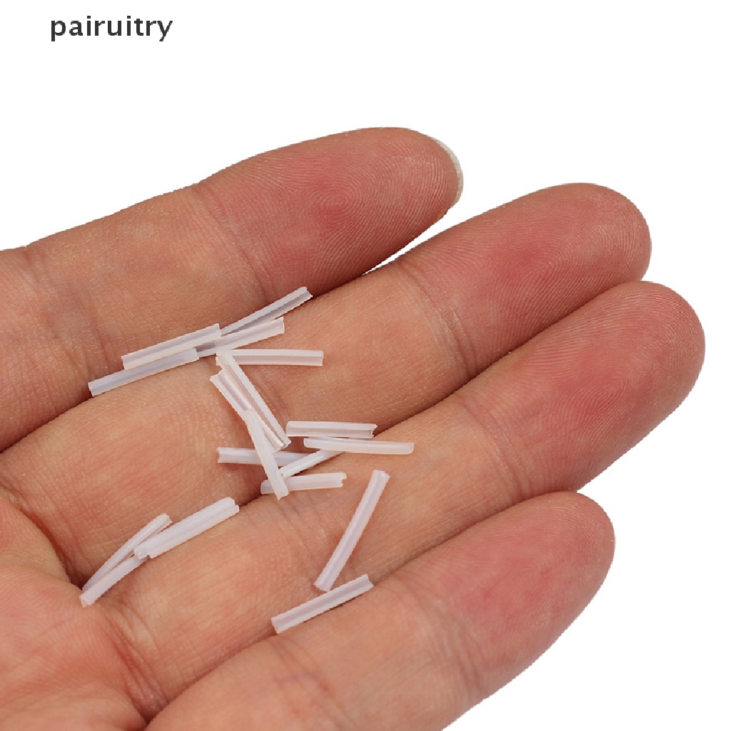 Prt 10pcs Pad Koreksi Kuku Kaki Ingrown Ortopedi PRT