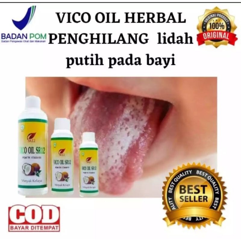 Obat lidah putih pada bayi obat lidah putih sariawan vco sr12 untuk lidah putih