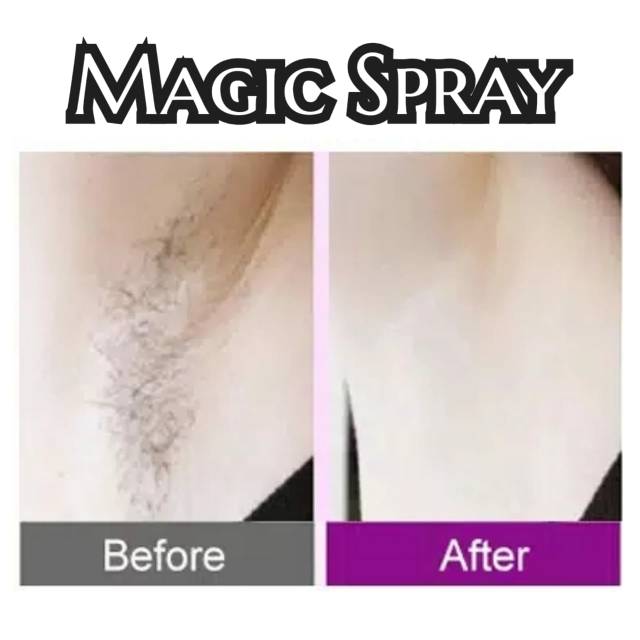 MAGIC SPRAY (Perontokbulu/HairRemoval)
