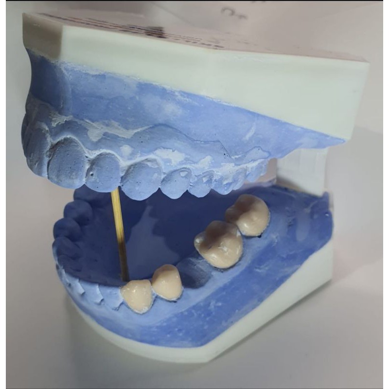 Phantom Gigi Praktikum Prostodonsia