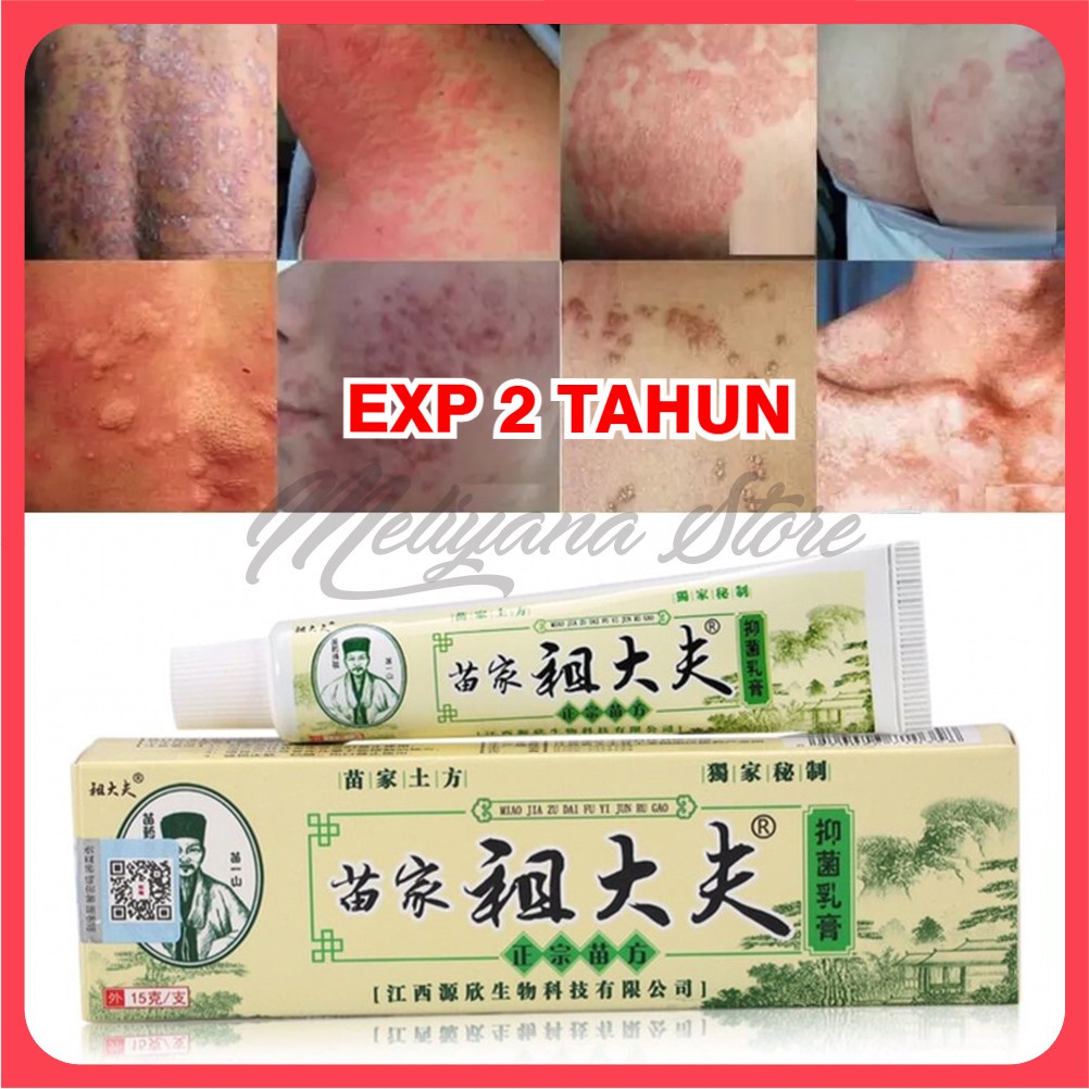 ZUDAIFU Salep Herbal Eczema Cream Eksim Psoriasis Jerawat Ruam Jamur Kudis Kurap