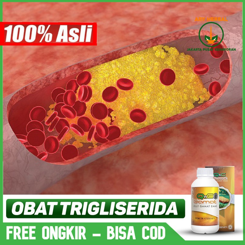 

Obat Trigliserida Tingggi, Demam, Mual, Nafsu Makan Berkurang Herbal QnC Jelly Gamat Bisa COD