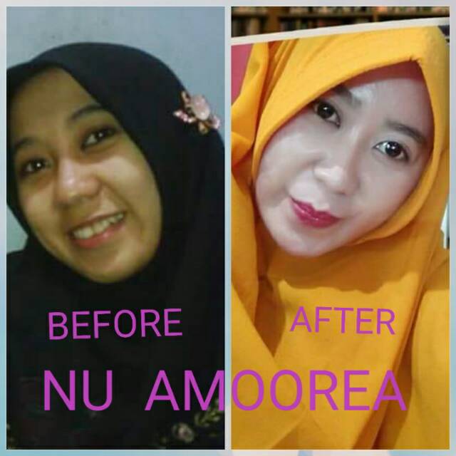 Paket perawatan kecantikan premium Khusus KULIT BERMINYAK Nu Amoorea Beauty Series Lengkap Hemat