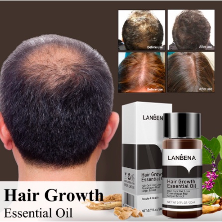 [BPOM] LANBENA Hair Growth Essential Oil & Care Essence Spray - Mencegah Kerontokan - 20mL-4