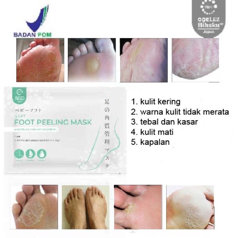 foot peeling mask AFC agelez bihaku footmask / foot mask untuk telapak kaki pecah pecah