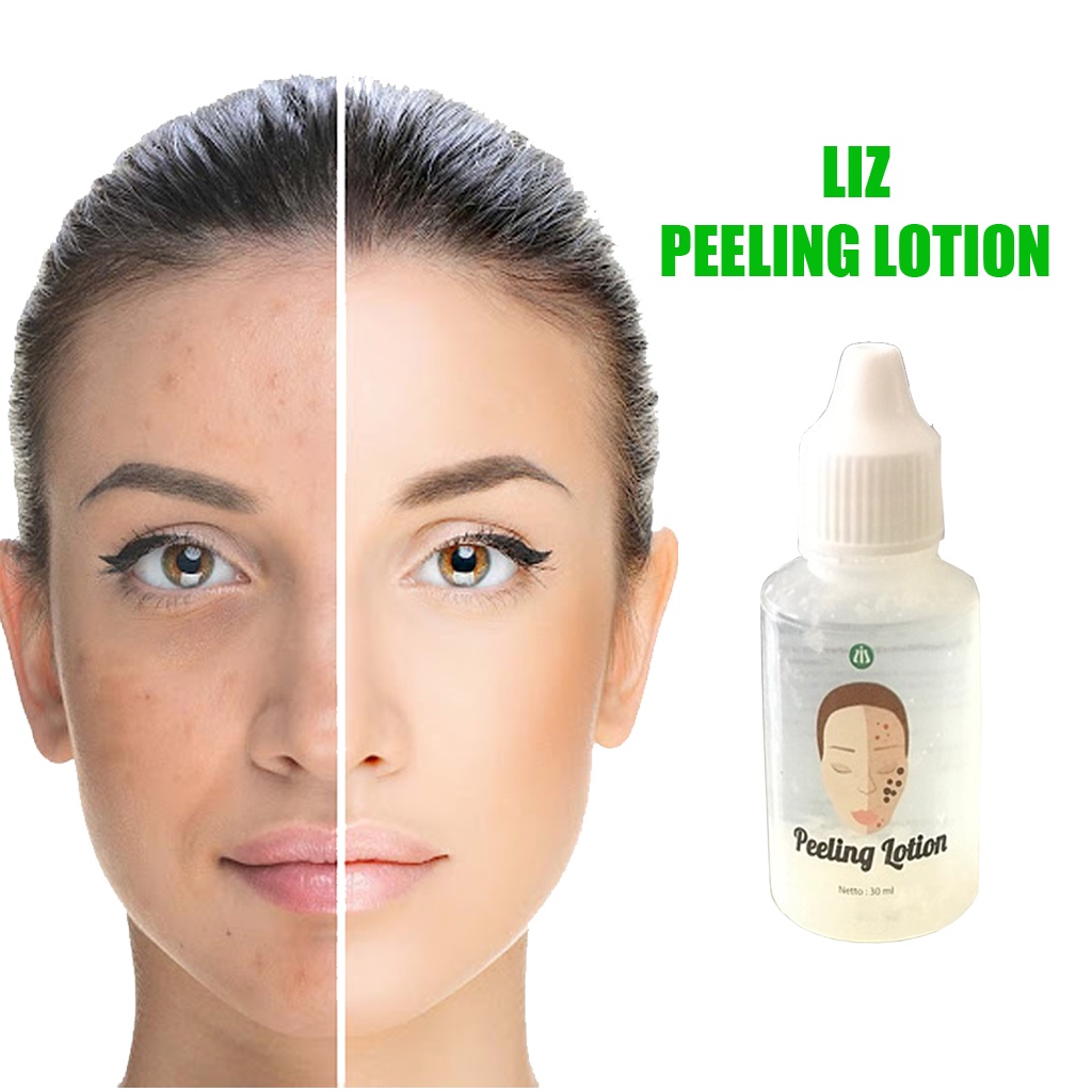 LIZ SKIN CARE Peeling Lotion 30 ml - Dr Listiyani LIS SKINCARE Kompres Jerawat 30ml