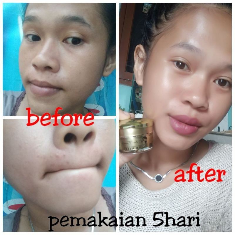 READY KEDAS BEAUTY GOLD JELLY ORIGINAL BPOM-8