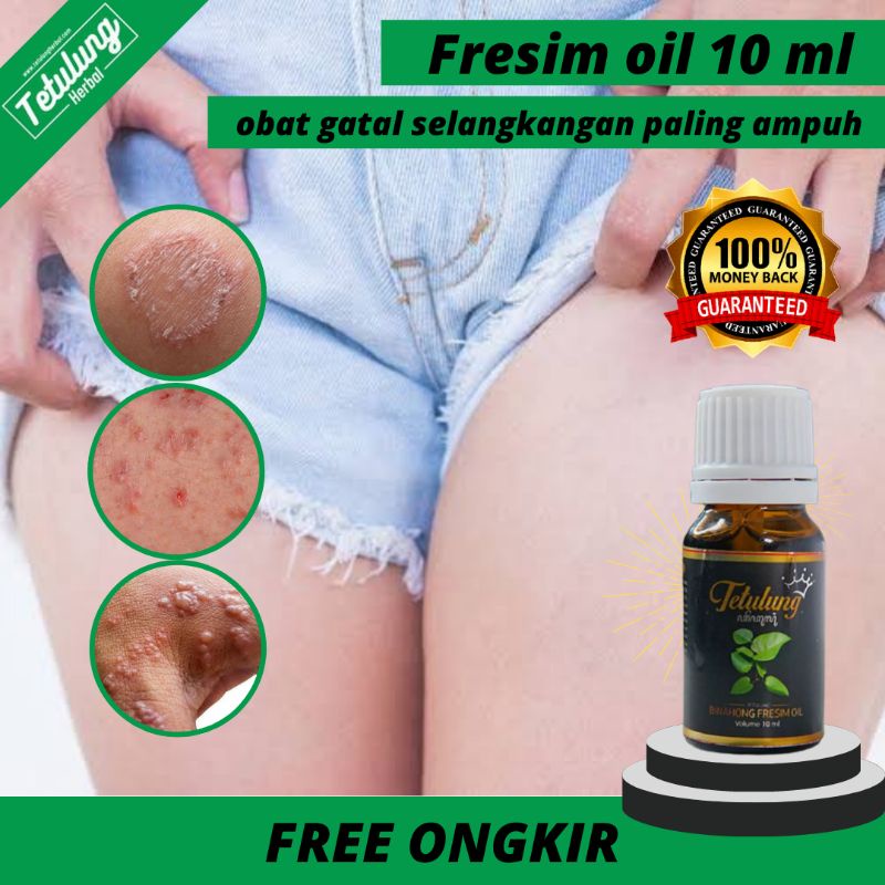 Obat Gatal Selangkangan Cewek Ampuh - Obat Gatal Area Kewanitaan - Obat Gatel Area Vagina Ampuh - Ob