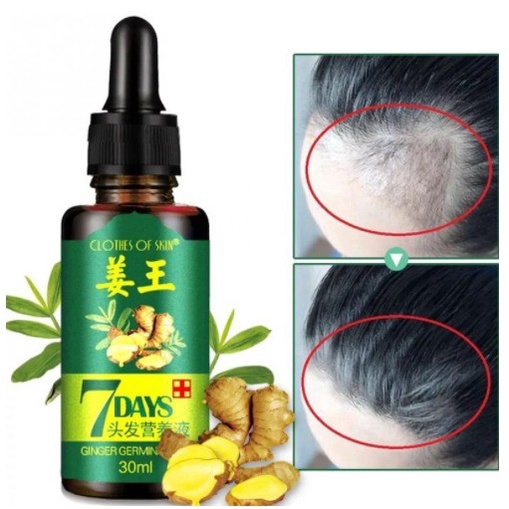 COD Obat penumbuh rambut botak depan/Penyubur Rambut - katumiri