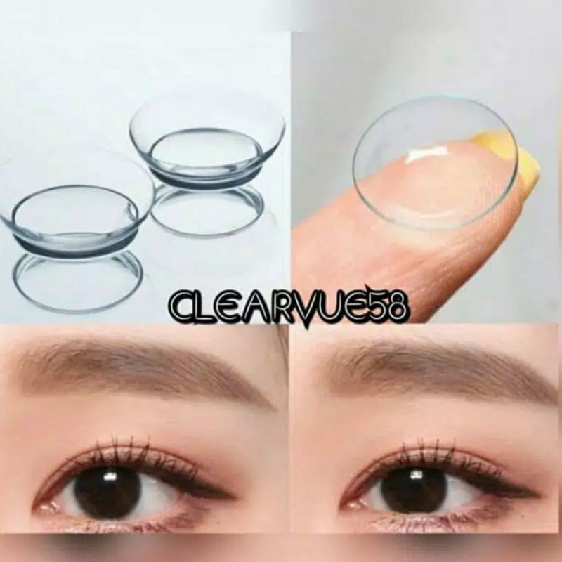 Softlens Bening Clear Bulanan CLEARVUE 14.2 MM MINUS -0.50 S.D -15.00