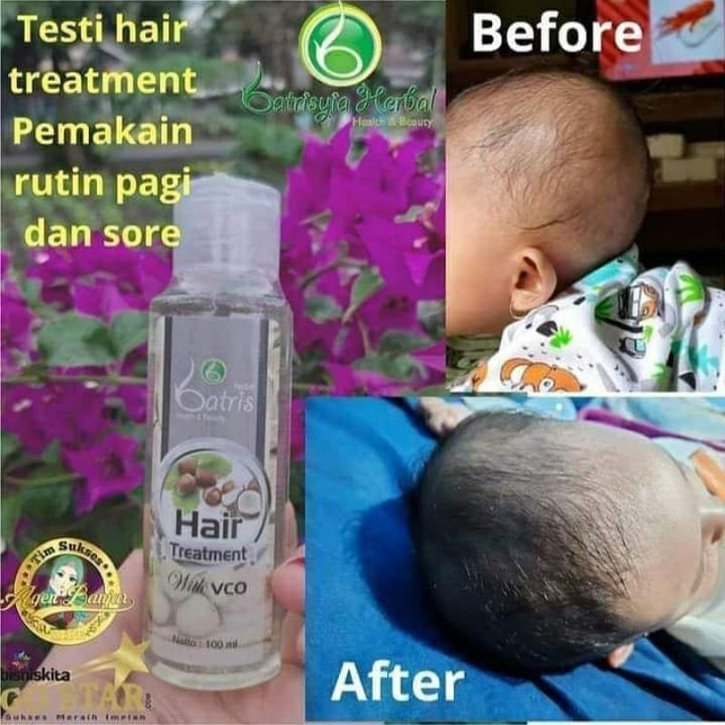 Baby hair treatment/ Penumbuh rambut anak/melebatkan rambut/menghitamkan rambut bahan alami bpom