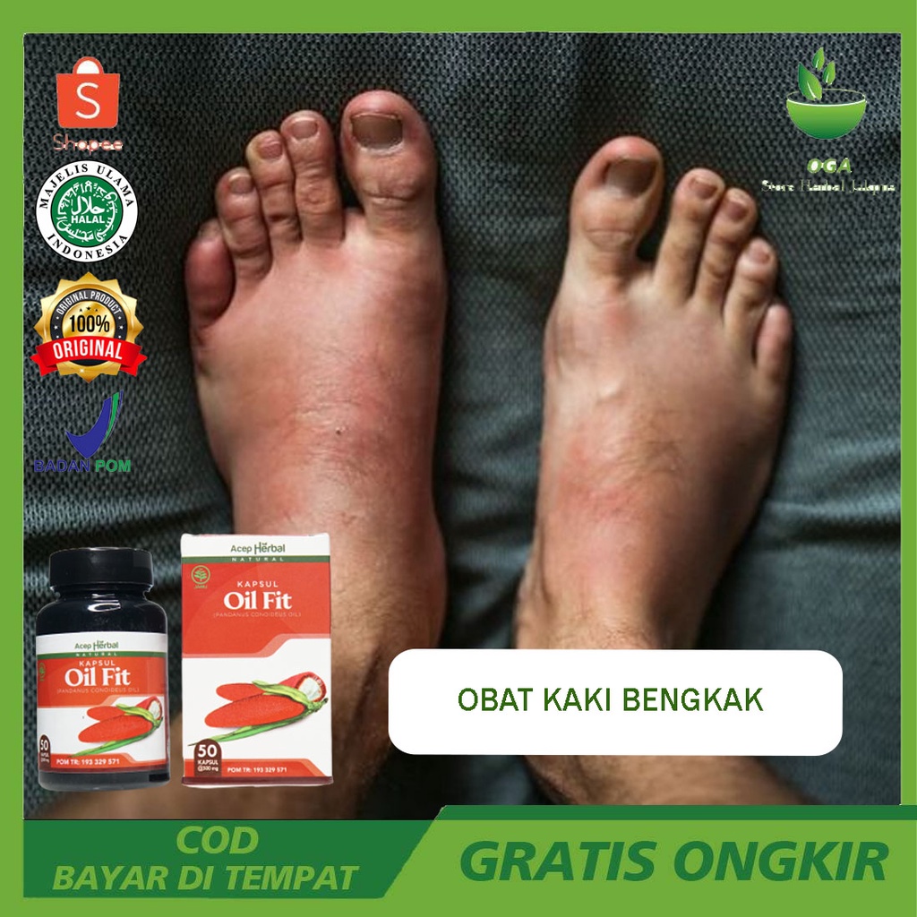 Minyak Oil Fit Kaki Bengkak - Buat Kaki Bengkak - Tangan Bengkak - Serasa di Pijat - Serasa di Urut 