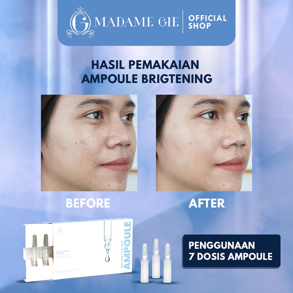 LIZBEAUTY - Madame Gie Brightening Ampoule Serum 5% Vit C - 5X Moisturizing Agent Moisturizer Cream Hydrating Lightening