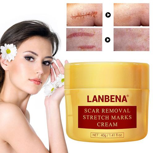 Lanbena Scar Removal Stretch Marks Cream - Penghilang Bekas Luka