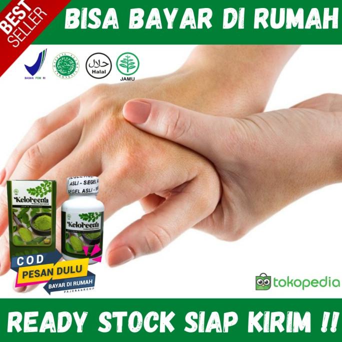 Obat Trigger Finger Herbal - Jari Tangan Kaku Dan Nyeri - Keloreena