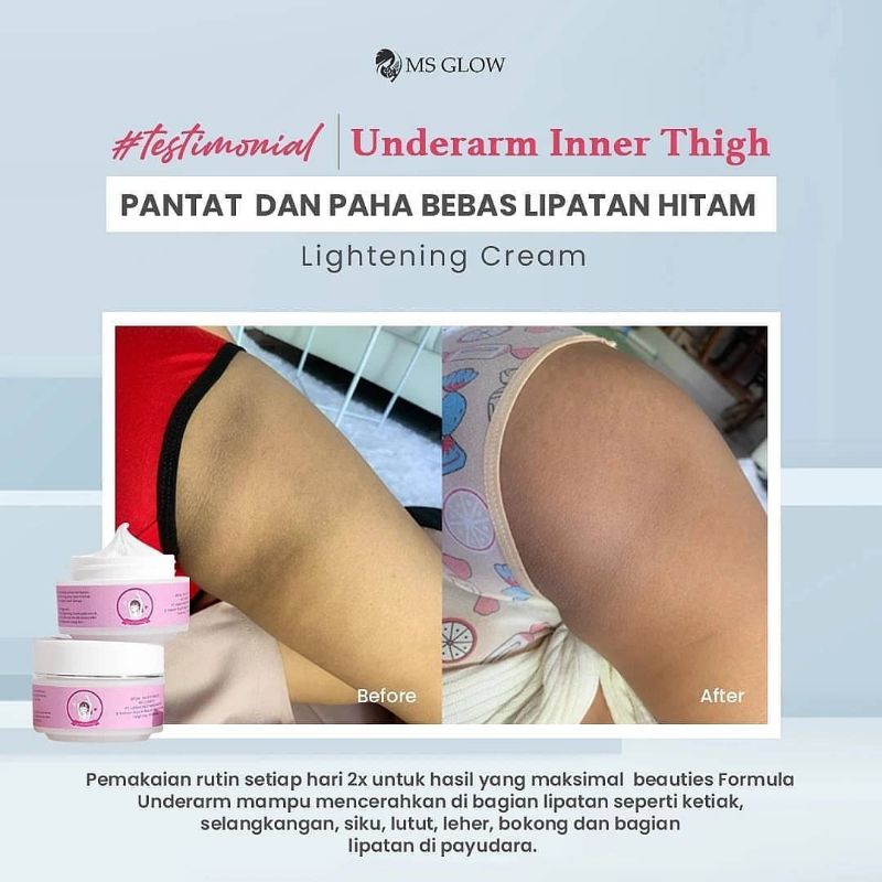 MSGLOW Underarm Pemutih Ketiak &amp; Selangkangan Bokong Mencerahkan Lipatan Hitam Mulus Halus MS GLOW