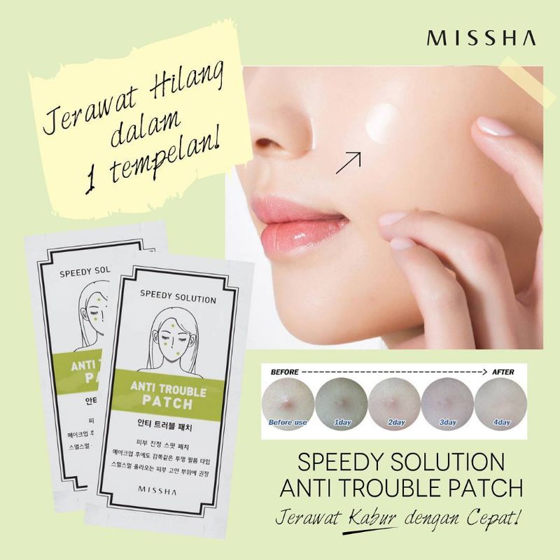 [BPOM] ACNE PATCH BY MISSHA ISI 12PATCH OBAT JERAWAT PATCH JERAWAT OBAT TOTOL JERAWAT STIKER JERAWAT ACNE SPOT TREATMENT JERAWAT OBAT TOTOL JERAWAT PENUTUP JERAWAT PENGEMPES JERAWAT TEMPELAN JERAWAT MASKER JERAWAT