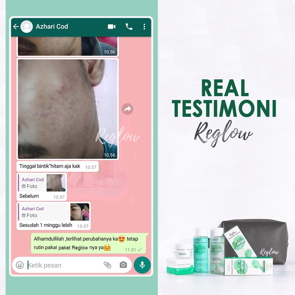 Paket Cream Dan Toner & MicellarWater REGLOW Utk menghilangkan Flek Jerawat Kerutan-5