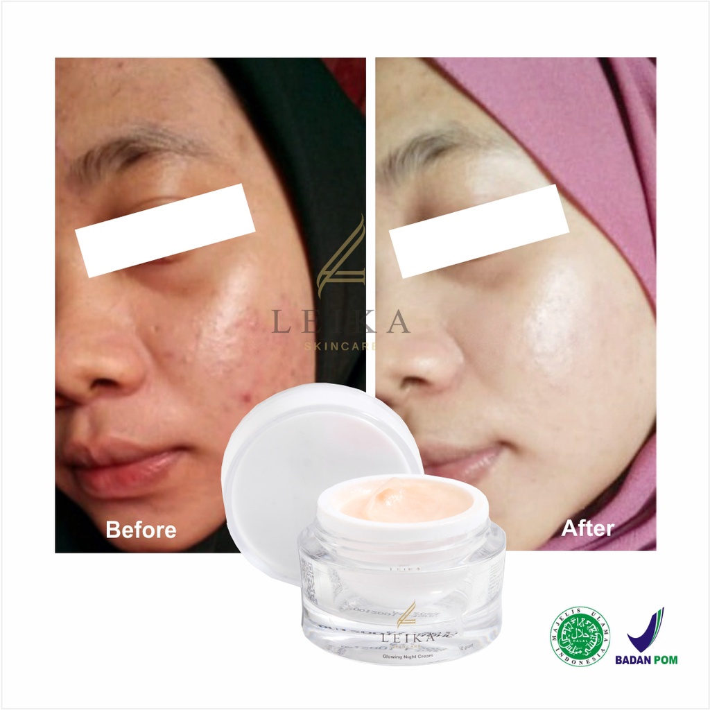 Leika Skincare Glowing Night Cream BPOM Halal MUI Perawatan Wajah Glowing Pencerah Wajah Kecantikan-3