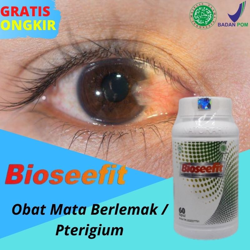 (COD) Obat Mata Pterigium/ Mata Berlemak / Lamad Mata BIOSEEFIT Ekstrak Billberry