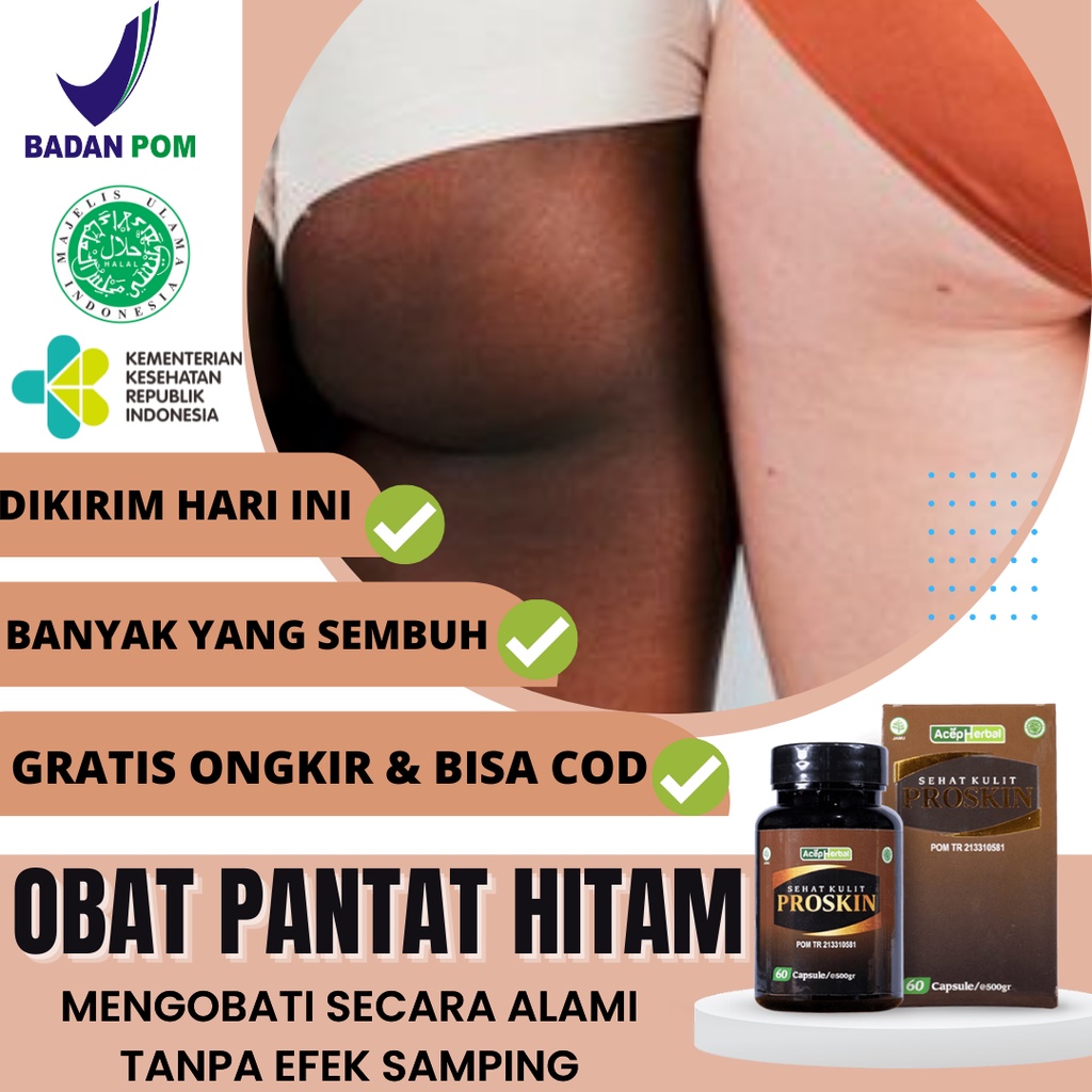Obat Pantat Burik Pantat Bruntusan Gatal di Pantat Obat Pemutih Pantat Hitam Obat Bisul di Pantat Ob
